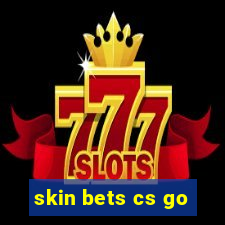 skin bets cs go