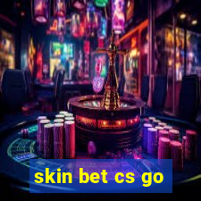 skin bet cs go