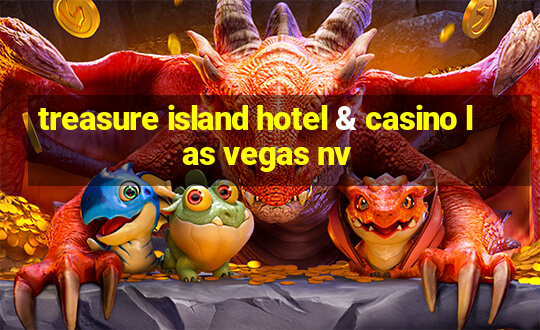 treasure island hotel & casino las vegas nv